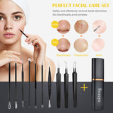 boxoyx 10 pcs pimple remover comedone extractor kit with box for quick and easy removal