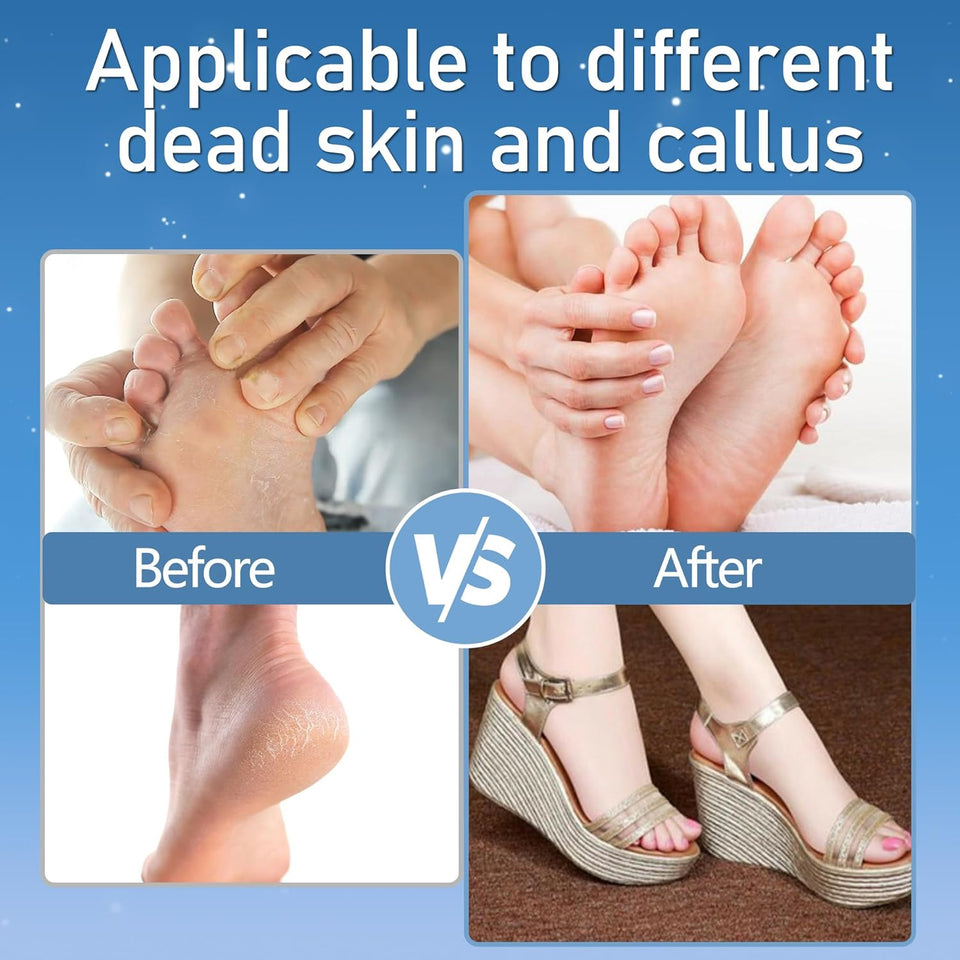 Callus Remover for Feet, Electric Foot Callus Remover Waterproof with 3 Rollers 2 Speed Battery Display,17 in1 Rechargeable Foot File Pedicure Kits for Dead Hard Cracked Dry Skin