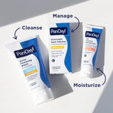 PanOxyl acne foaming wash, 10% benzoyl peroxide maximum strength, antimicrobial, 5.5 oz